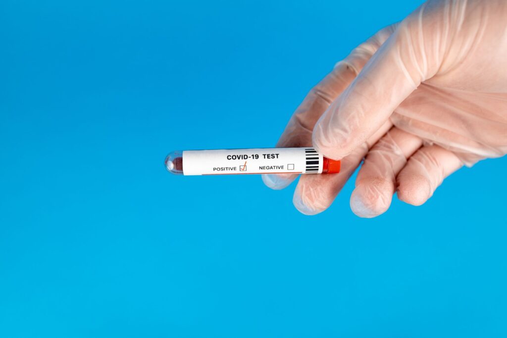 Gloved hand holding COVID-19 test tube with blood sample against blue background.