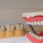Close-up image showing detailed dental models and dentures on display, ideal for dental education.