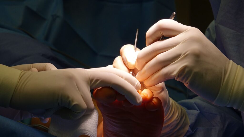 Gloved hands performing intricate foot surgery in a sterile operating environment.