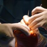 Gloved hands performing intricate foot surgery in a sterile operating environment.