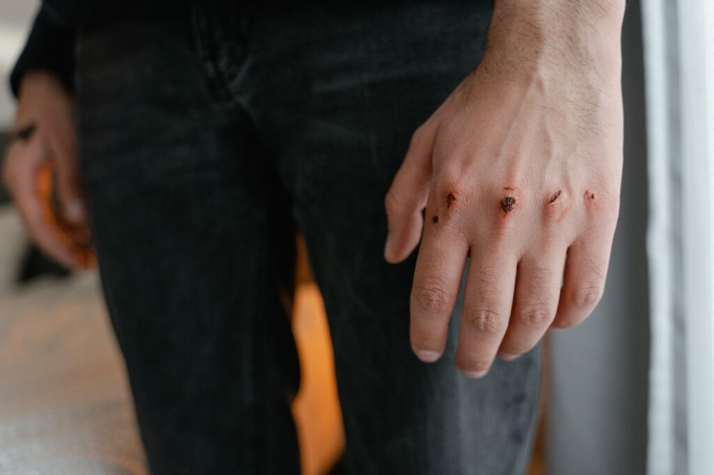 Detailed image of a hand with visible wounds and scratches, emphasizing injury.