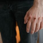Detailed image of a hand with visible wounds and scratches, emphasizing injury.
