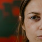 Close-up portrait of a woman with a bruised eye, depicting emotion and resilience.