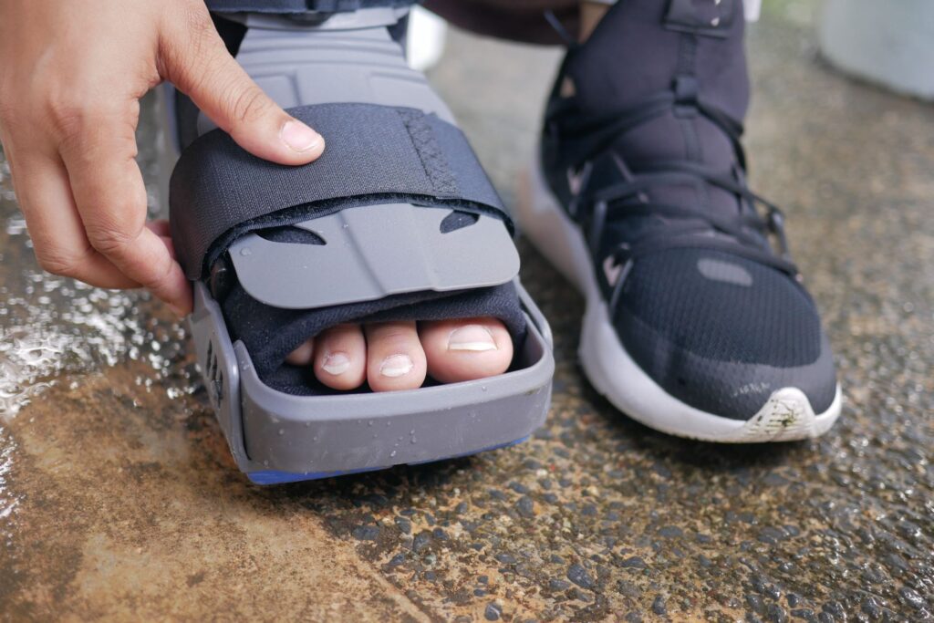 Detailed close-up of a foot in an orthopedic brace, highlighting post-injury recovery.
