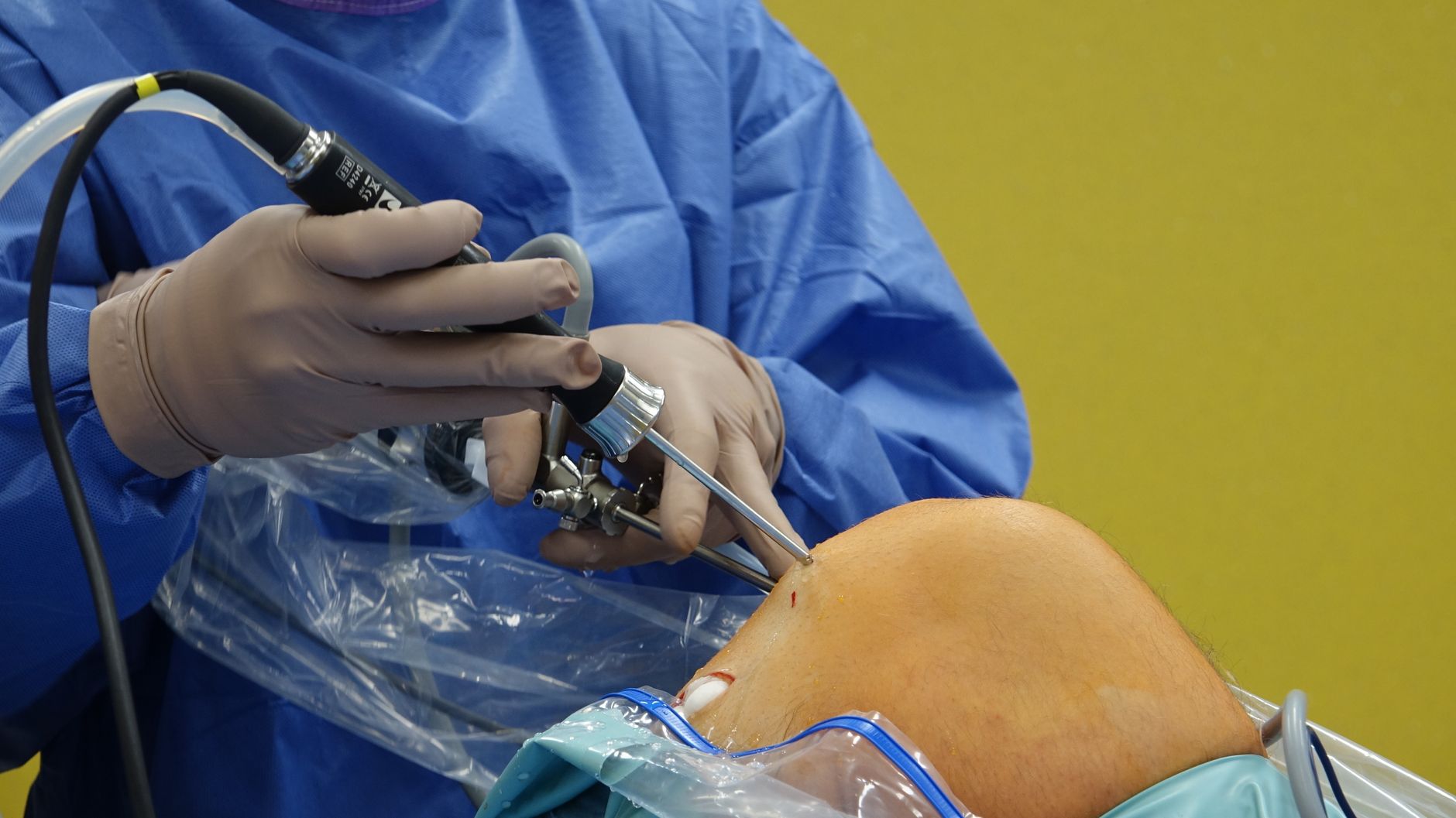 Surgeon using arthroscope for precise knee surgery in operating room.