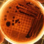 Close-up of bacteria colonies in a petri dish under laboratory conditions.