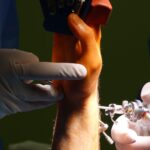 Detailed view of wrist surgery procedure with medical instruments and gloved hands.